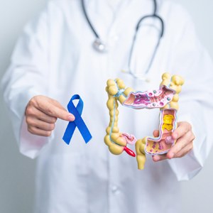 Dilluns 31 de març, Dia Mundial Contra el Càncer de Còlon.